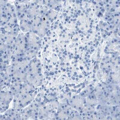 Immunohistochemistry-Paraffin: CD46 Antibody [NBP1-82790]