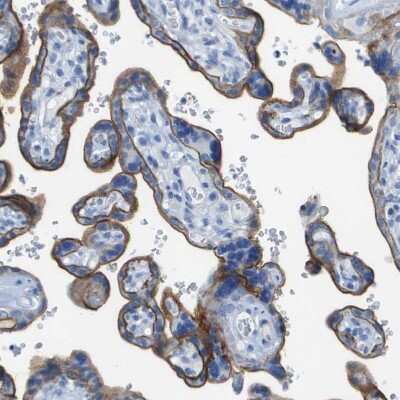 Immunohistochemistry-Paraffin: CD46 Antibody [NBP1-82790]