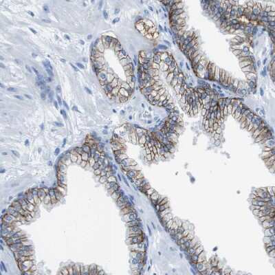 Immunohistochemistry-Paraffin: CD46 Antibody [NBP1-82790]