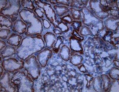 Immunohistochemistry-Frozen: CD46 Antibody (M177) [NBP1-51131]