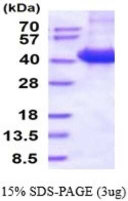 SDS-PAGE: Recombinant Human CD46 His Protein [NBP2-53048]