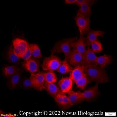 Immunocytochemistry/ Immunofluorescence: CD47 Antibody (B6H12.2) - Azide and BSA Free [NBP2-31106]