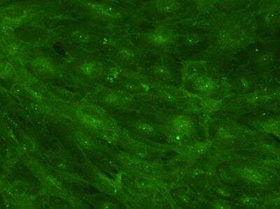 Immunocytochemistry: CD47 Antibody (B6H12.2) - Azide and BSA Free [NBP2-31106]