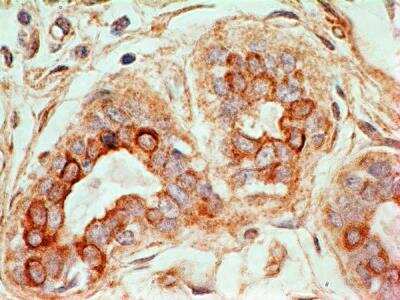 Immunohistochemistry-Paraffin: CD47 Antibody (B6H12.2) - Azide and BSA Free [NBP2-31106]