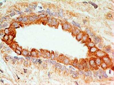Immunohistochemistry-Paraffin: CD47 Antibody (B6H12.2) - Azide and BSA Free [NBP2-31106]