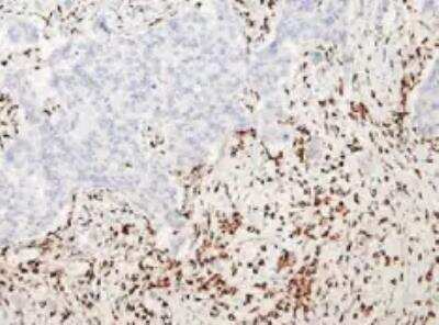 Immunohistochemistry-Paraffin: CD47 Antibody (B6H12.2) - Azide and BSA Free [NBP2-31106]