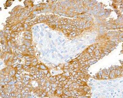 Immunohistochemistry: CD47 Antibody (BLR131H) [NBP3-14713]