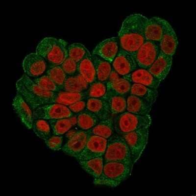 Immunocytochemistry/ Immunofluorescence: CD47 Antibody (CD47/3019) - Azide and BSA Free [NBP3-08976]