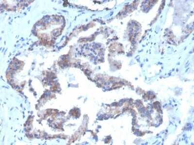 Immunohistochemistry-Paraffin: CD47 Antibody (CD47/3019) - Azide and BSA Free [NBP3-08976]