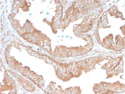 Immunohistochemistry-Paraffin: CD47 Antibody (CD47/3019) [NBP3-08975]
