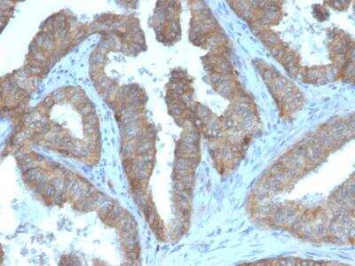 Immunohistochemistry-Paraffin: CD47 Antibody (CD47/3019) [NBP3-08975]