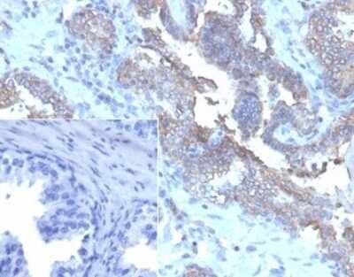 Immunohistochemistry-Paraffin: CD47 Antibody (CD47/6362R) - Azide and BSA Free [NBP3-08218]