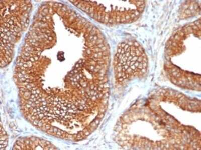 Immunohistochemistry-Paraffin: CD47 Antibody (CD47/6362R) - Azide and BSA Free [NBP3-08218]