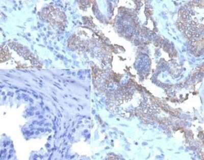 Immunohistochemistry-Paraffin: CD47 Antibody (CD47/6362R) [NBP3-07224]