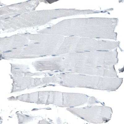 Immunohistochemistry-Paraffin: CD47 Antibody (CL6913) [NBP2-76511]