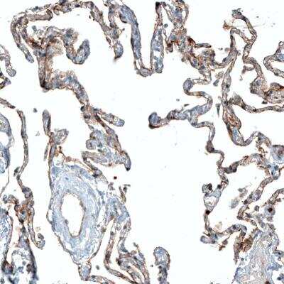 Immunohistochemistry-Paraffin: CD47 Antibody (CL6913) [NBP2-76511]