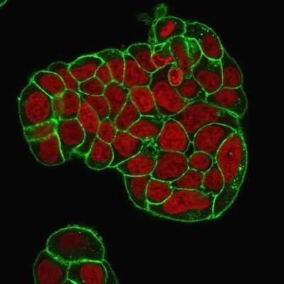 Immunocytochemistry/ Immunofluorescence: CD47 Antibody (IAP/964 + B6H12.2) - Azide and BSA Free [NBP2-47812]