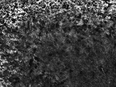 Immunohistochemistry-Frozen: CD47 Antibody (IAP/964 + B6H12.2) - Azide and BSA Free [NBP2-47812]