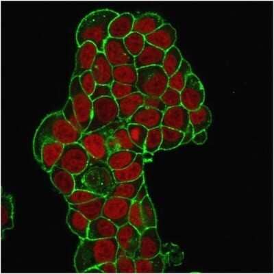 Immunocytochemistry/ Immunofluorescence: CD47 Antibody (IAP/964) [NBP2-44408]