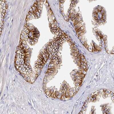 Immunohistochemistry-Paraffin: CD47 Antibody [NBP2-32031]