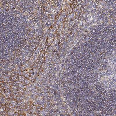 Immunohistochemistry-Paraffin: CD47 Antibody [NBP2-32031]