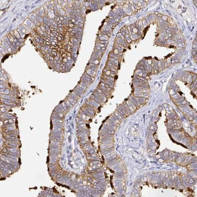 Immunohistochemistry-Paraffin: CD47 Antibody [NBP2-32031]