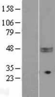 Western Blot: CD47 Overexpression Lysate [NBL1-08954]