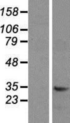 Western Blot: CD47 Overexpression Lysate [NBP2-10084]