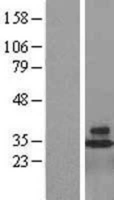 Western Blot: CD48/SLAMF2 Overexpression Lysate [NBL1-08955]