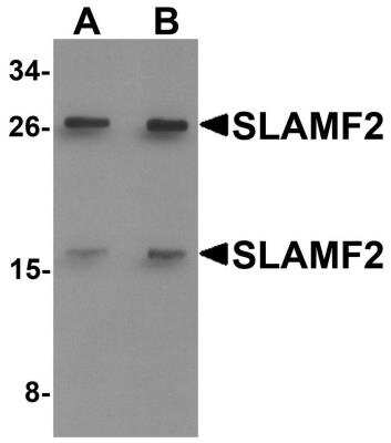 Western Blot: CD48/SLAMF2 AntibodyBSA Free [NBP1-76556]