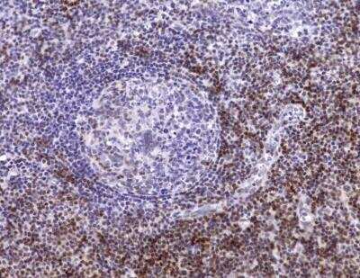 Immunohistochemistry-Paraffin: CD5 Antibody (C5/473 + CD5/54/F6) - Azide and BSA Free [NBP2-34583]