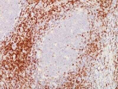 Immunohistochemistry-Paraffin: CD5 Antibody (C5/473 + CD5/54/F6) - IHC-Prediluted [NBP2-44921]