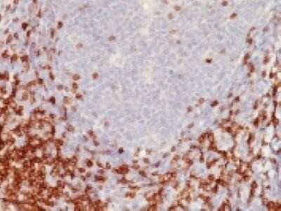 Immunohistochemistry-Paraffin: CD5 Antibody (C5/473) - Azide and BSA Free [NBP2-34582]