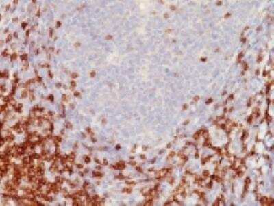 Immunohistochemistry-Paraffin: CD5 Antibody (C5/473) [NBP2-32940]