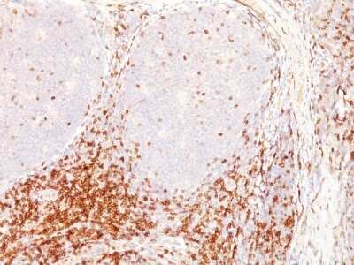 Immunohistochemistry-Paraffin: CD5 Antibody (CD5/54/F6) - Azide and BSA Free [NBP2-34593]