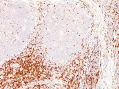 Immunohistochemistry-Paraffin: CD5 Antibody (CD5/54/F6) - IHC-Prediluted [NBP2-44920]