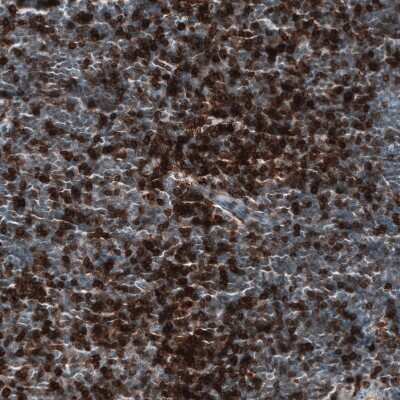 Immunohistochemistry-Paraffin: CD5 Antibody (CL12334) [NBP3-15133]