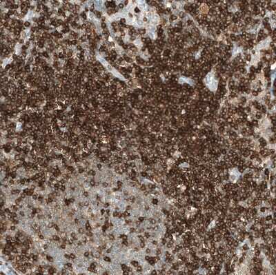 Immunohistochemistry-Paraffin: CD5 Antibody (CL12334) [NBP3-15133]