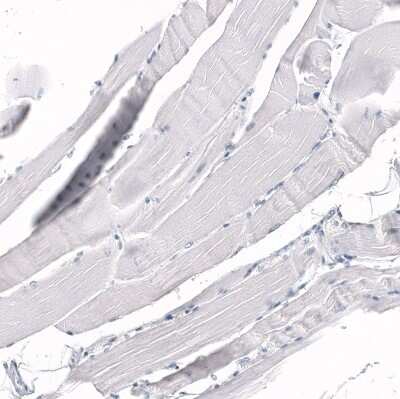 Immunohistochemistry-Paraffin: CD5 Antibody (CL12334) [NBP3-15133]