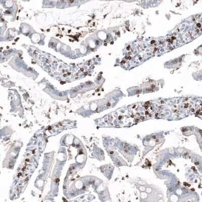 Immunohistochemistry-Paraffin: CD5 Antibody (CL12334) [NBP3-15133]