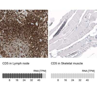 Immunohistochemistry-Paraffin: CD5 Antibody (CL12334) [NBP3-15133]