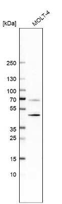 Western Blot: CD5 Antibody (CL12334) [NBP3-15133]