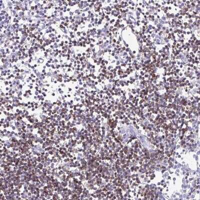 Immunohistochemistry-Paraffin: CD5 Antibody [NBP2-38900]