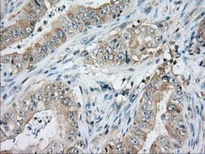Immunohistochemistry: CD5 Antibody (OTI7A7) - Azide and BSA Free [NBP2-70360]