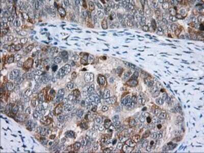 Immunohistochemistry: CD5 Antibody (OTI7A7) - Azide and BSA Free [NBP2-70360]