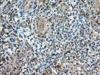 Immunohistochemistry: CD5 Antibody (OTI7A7) - Azide and BSA Free [NBP2-70360]