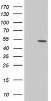 Western Blot: CD5 Antibody (OTI7A7)Azide and BSA Free [NBP2-70360]