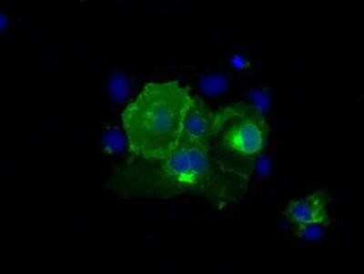 Immunocytochemistry/ Immunofluorescence: CD5 Antibody (OTI7A7) [NBP2-02690]