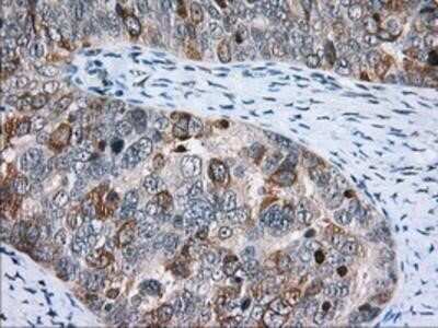 Immunohistochemistry-Paraffin: CD5 Antibody (OTI7A7) [NBP2-02690]