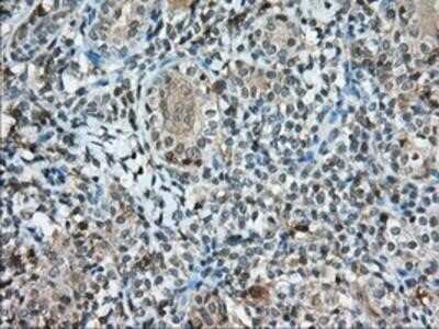 Immunohistochemistry-Paraffin: CD5 Antibody (OTI7A7) [NBP2-02690]